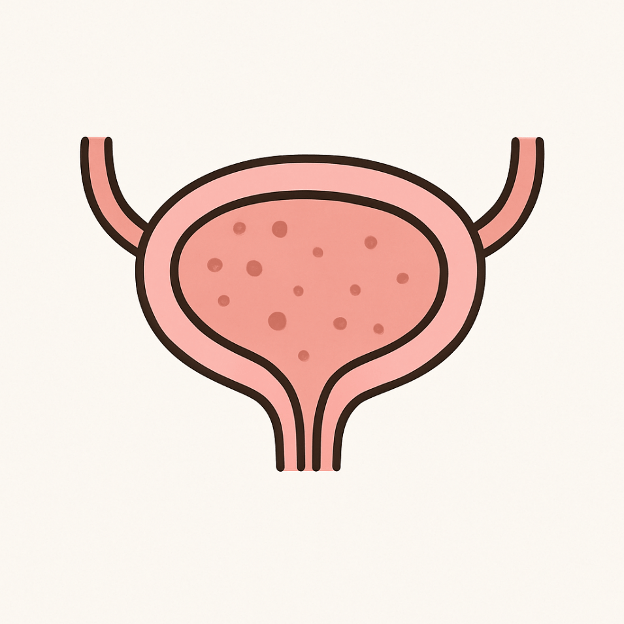 [전문가 조언 #124] 세부암 –  방광암은 왜 재발률이&nbsp;높나요?